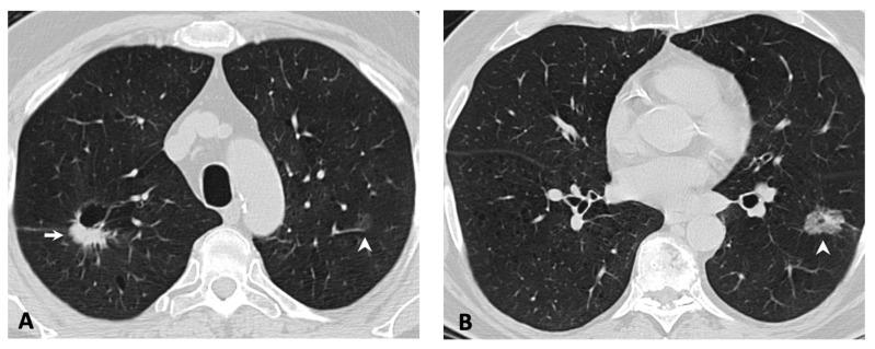 https://cdn.ncbi.nlm.nih.gov/pmc/blobs/3b41/6966679/2cbeb8a9ff6d/cancers-11-02033-g002.jpg