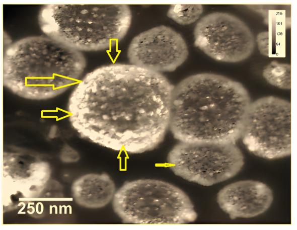 https://cdn.ncbi.nlm.nih.gov/pmc/blobs/3b46/10160449/b0dd458d72a6/fonc-13-1102269-g005.jpg