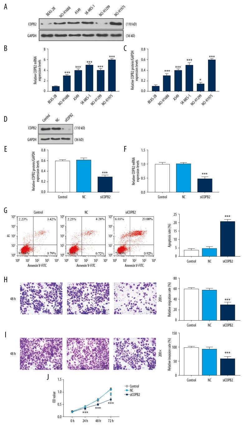 https://cdn.ncbi.nlm.nih.gov/pmc/blobs/3b5b/7006366/86dd432af275/medscimonit-26-e918382-g001.jpg