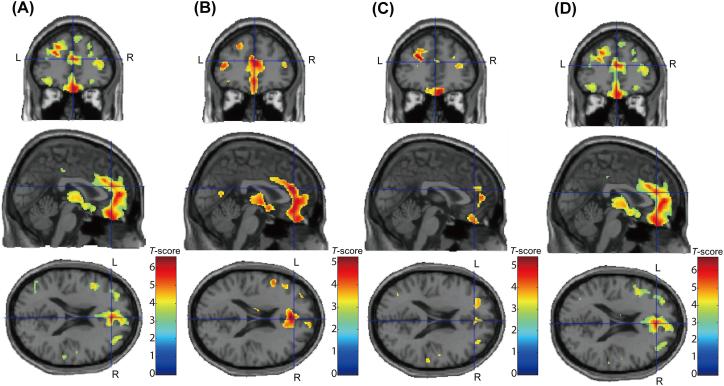 https://cdn.ncbi.nlm.nih.gov/pmc/blobs/3b60/5554933/2a6d48ca9c31/gr4.jpg