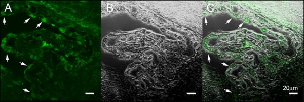https://cdn.ncbi.nlm.nih.gov/pmc/blobs/3b61/2949735/fc78afc00bad/1743-8454-7-15-8.jpg
