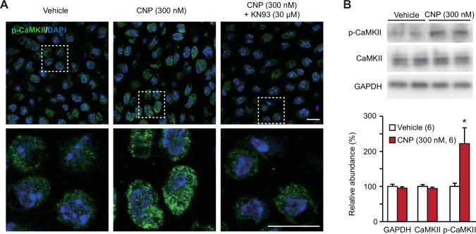 https://cdn.ncbi.nlm.nih.gov/pmc/blobs/3b64/8923661/5bddd4b82a1a/elife-71931-fig6.jpg