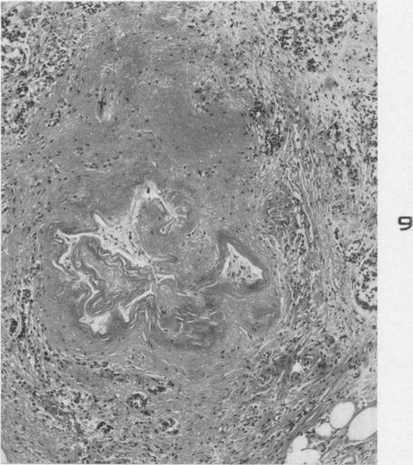 https://cdn.ncbi.nlm.nih.gov/pmc/blobs/3b68/1942811/273520cf46bb/amjpathol00602-0128-b.jpg