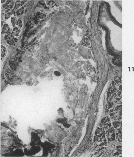 https://cdn.ncbi.nlm.nih.gov/pmc/blobs/3b68/1942811/4313099487c2/amjpathol00602-0128-d.jpg