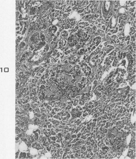 https://cdn.ncbi.nlm.nih.gov/pmc/blobs/3b68/1942811/f7ece1fdaa83/amjpathol00602-0128-c.jpg