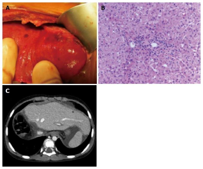https://cdn.ncbi.nlm.nih.gov/pmc/blobs/3b6b/5124993/133c41731973/WJG-22-9865-g003.jpg
