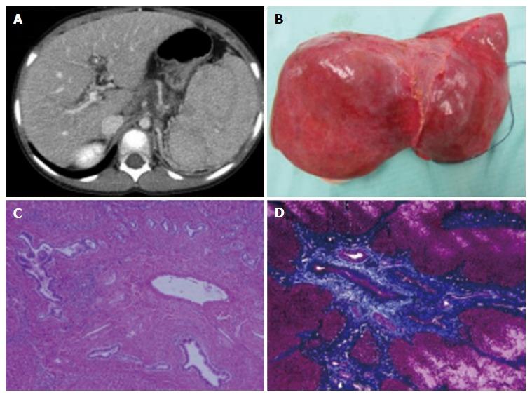 https://cdn.ncbi.nlm.nih.gov/pmc/blobs/3b6b/5124993/b8b72ccb4011/WJG-22-9865-g001.jpg