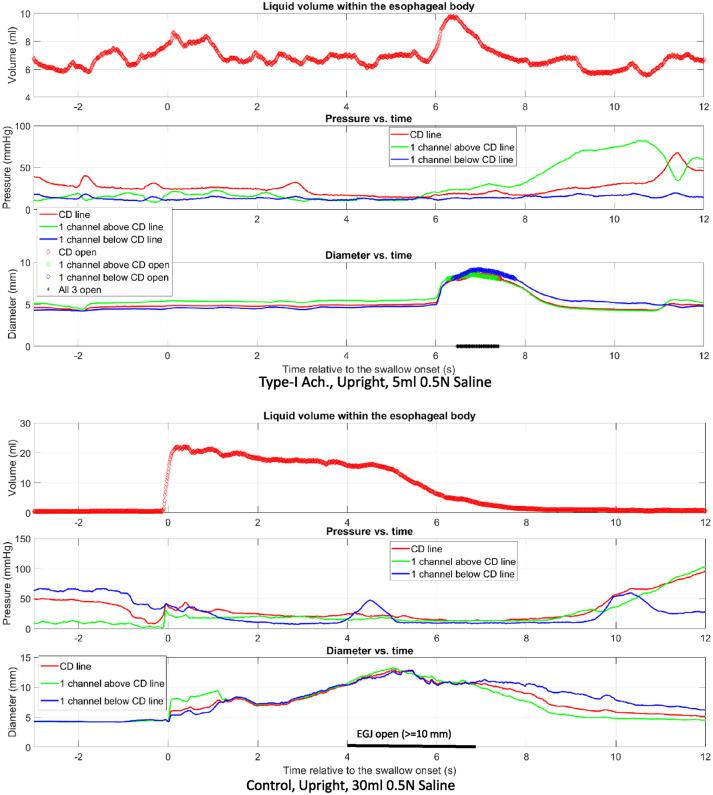 https://cdn.ncbi.nlm.nih.gov/pmc/blobs/3b71/7592175/6f8585d29533/10.1177_1756284820969050-fig4.jpg
