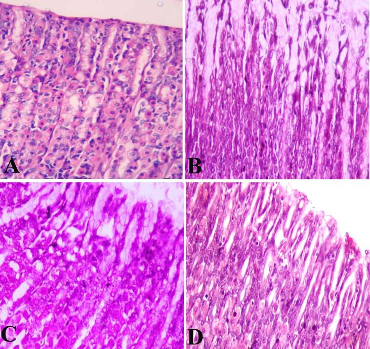 https://cdn.ncbi.nlm.nih.gov/pmc/blobs/3b72/7715057/b184204c7311/gr2.jpg