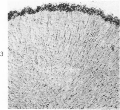 https://cdn.ncbi.nlm.nih.gov/pmc/blobs/3b73/1942325/27d20afc648b/amjpathol00338-0120-c.jpg