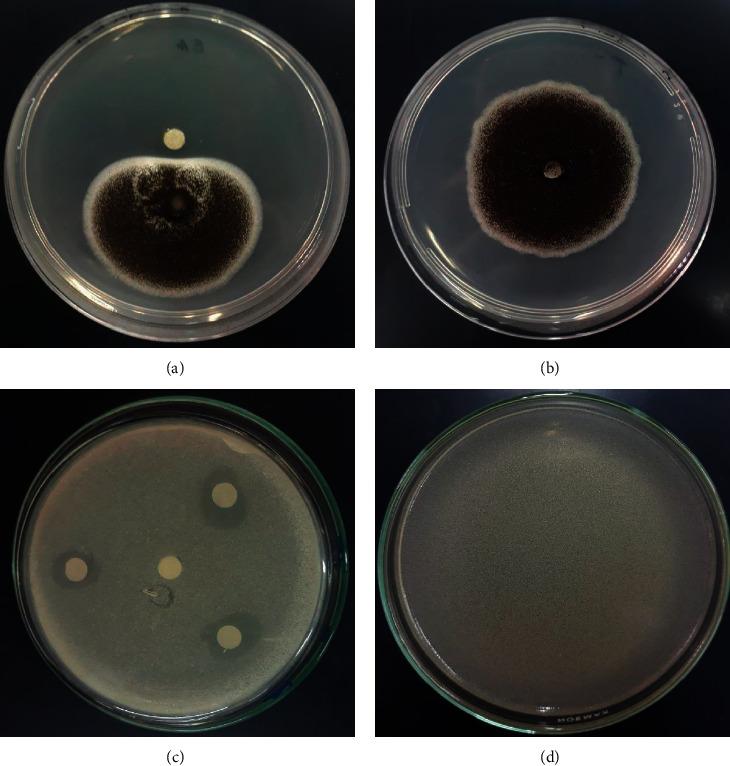 https://cdn.ncbi.nlm.nih.gov/pmc/blobs/3b7a/8536417/0a5b0d93b367/ECAM2021-1108133.003.jpg