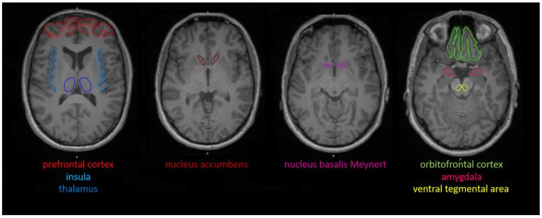 https://cdn.ncbi.nlm.nih.gov/pmc/blobs/3b7e/9775559/83696464c185/brainsci-12-01648-g001.jpg