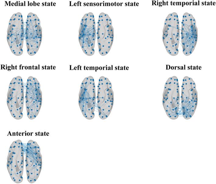 https://cdn.ncbi.nlm.nih.gov/pmc/blobs/3b84/9804064/98797c9cd75a/CNS-29-296-g002.jpg