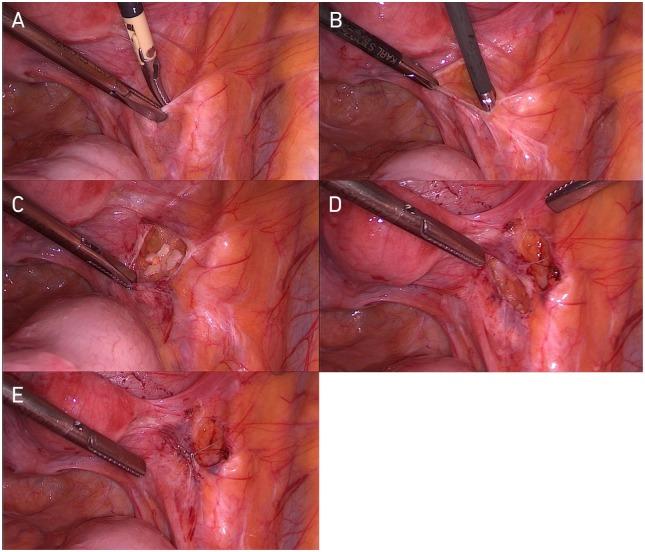 https://cdn.ncbi.nlm.nih.gov/pmc/blobs/3b8b/6685107/e5bf6b7a4d22/10.1177_1179558119867357-fig1.jpg