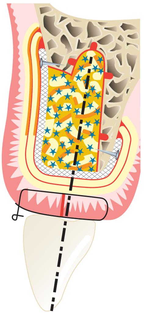 https://cdn.ncbi.nlm.nih.gov/pmc/blobs/3b8f/11808411/09ac3d9dcf43/PRD-97-420-g008.jpg