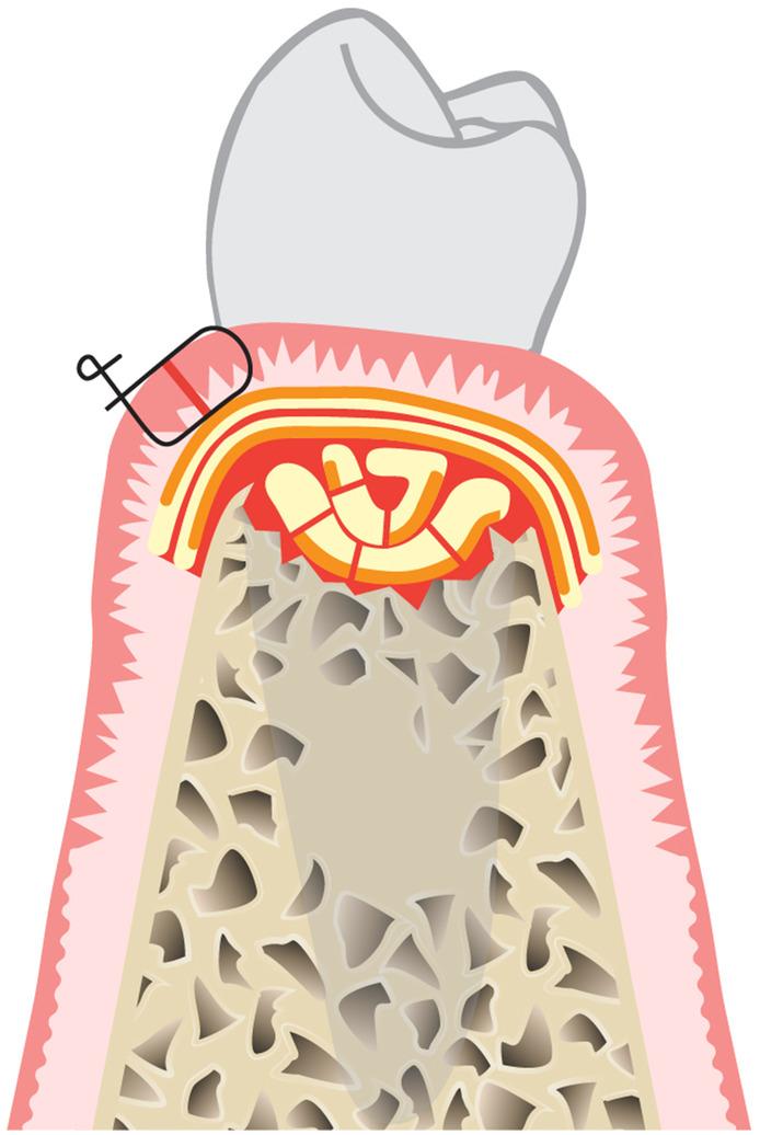 https://cdn.ncbi.nlm.nih.gov/pmc/blobs/3b8f/11808411/112e5bf1b64b/PRD-97-420-g011.jpg