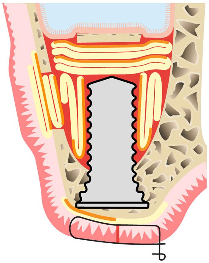 https://cdn.ncbi.nlm.nih.gov/pmc/blobs/3b8f/11808411/140b0404ae94/PRD-97-420-g004.jpg