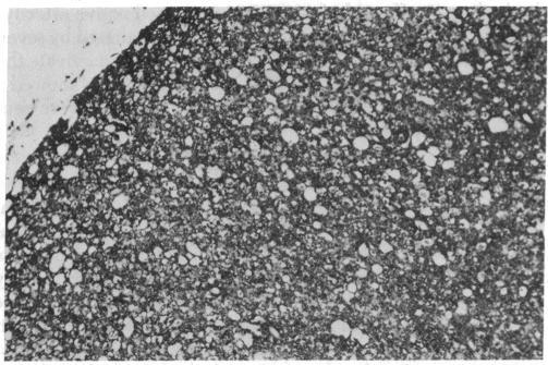 https://cdn.ncbi.nlm.nih.gov/pmc/blobs/3b91/383268/1ef580995fdf/pnas00003-0443-b.jpg