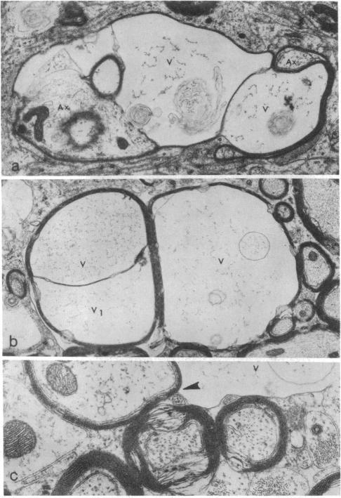 https://cdn.ncbi.nlm.nih.gov/pmc/blobs/3b91/383268/8a76e5b4177c/pnas00003-0444-a.jpg