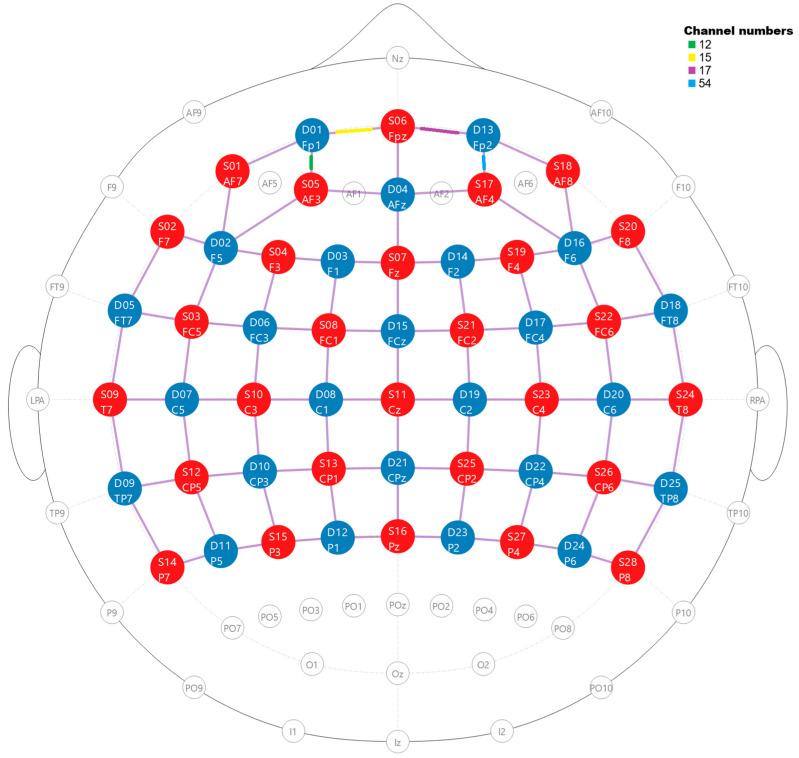 https://cdn.ncbi.nlm.nih.gov/pmc/blobs/3b93/12025600/368ba6dfed4e/brainsci-15-00411-g003.jpg