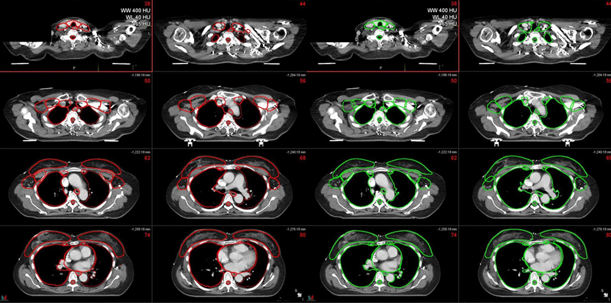 https://cdn.ncbi.nlm.nih.gov/pmc/blobs/3b95/7905884/52c3a0752160/13014_2021_1771_Fig2_HTML.jpg