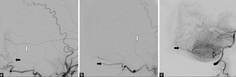 https://cdn.ncbi.nlm.nih.gov/pmc/blobs/3b96/4392537/776aac8b5fe5/SNI-6-40-g004.jpg