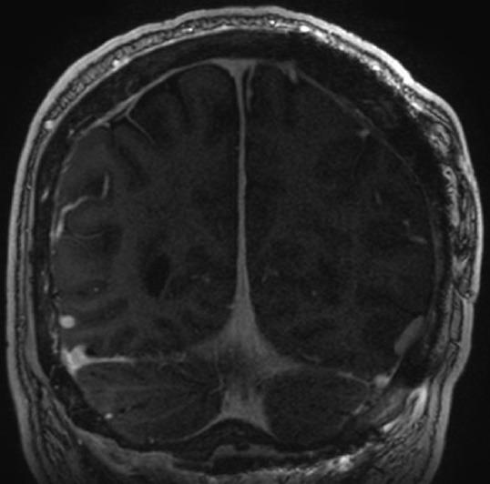 https://cdn.ncbi.nlm.nih.gov/pmc/blobs/3b96/4392537/b82bca9885f0/SNI-6-40-g007.jpg