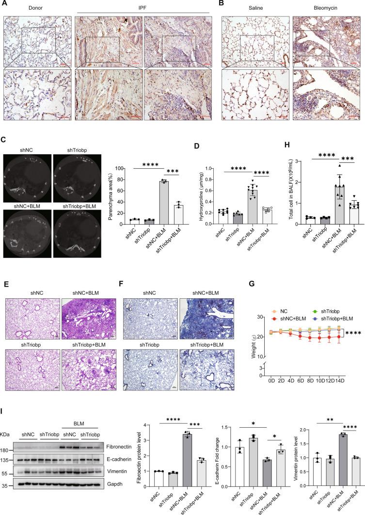 https://cdn.ncbi.nlm.nih.gov/pmc/blobs/3bb2/11072289/e5c86610a05b/18_2023_5080_Fig2_HTML.jpg