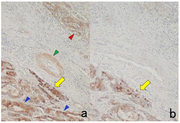 https://cdn.ncbi.nlm.nih.gov/pmc/blobs/3bb4/8232789/08c3efff5fed/cells-10-01501-g017.jpg
