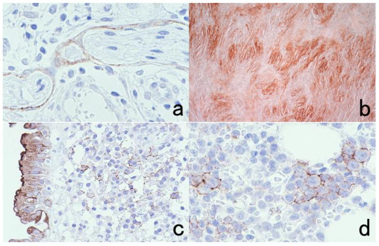 https://cdn.ncbi.nlm.nih.gov/pmc/blobs/3bb4/8232789/21015744dd17/cells-10-01501-g055.jpg