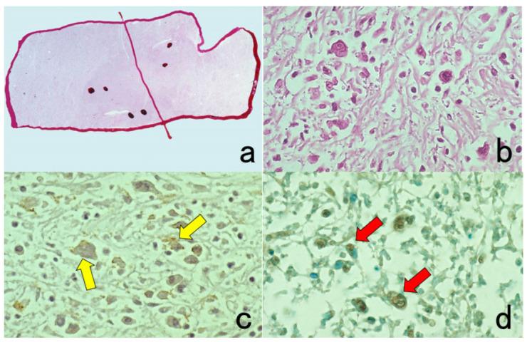https://cdn.ncbi.nlm.nih.gov/pmc/blobs/3bb4/8232789/40560e724b4c/cells-10-01501-g008.jpg