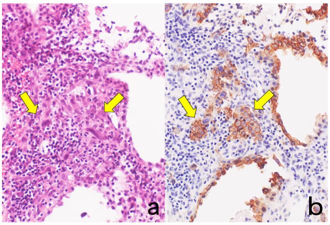https://cdn.ncbi.nlm.nih.gov/pmc/blobs/3bb4/8232789/793a51547bd8/cells-10-01501-g001.jpg
