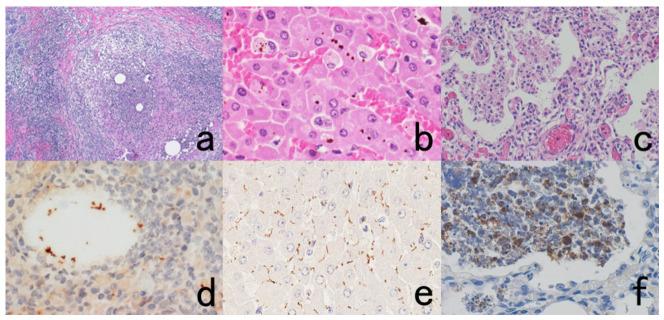 https://cdn.ncbi.nlm.nih.gov/pmc/blobs/3bb4/8232789/8c36b9152ed4/cells-10-01501-g060.jpg