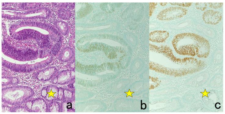 https://cdn.ncbi.nlm.nih.gov/pmc/blobs/3bb4/8232789/9403f3cbeac1/cells-10-01501-g034.jpg