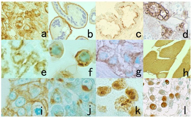 https://cdn.ncbi.nlm.nih.gov/pmc/blobs/3bb4/8232789/b545a7568248/cells-10-01501-g045.jpg