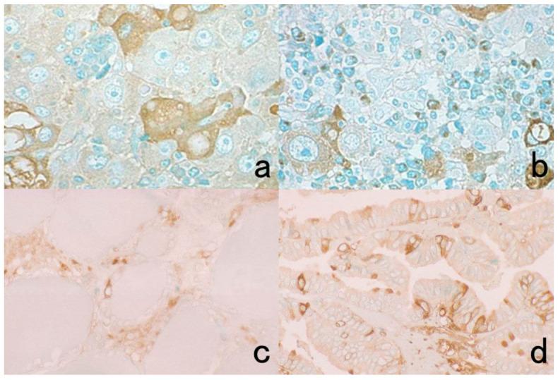 https://cdn.ncbi.nlm.nih.gov/pmc/blobs/3bb4/8232789/bd3067c5a2b6/cells-10-01501-g012.jpg