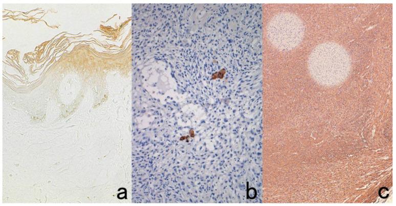 https://cdn.ncbi.nlm.nih.gov/pmc/blobs/3bb4/8232789/ca186fb3db42/cells-10-01501-g023.jpg