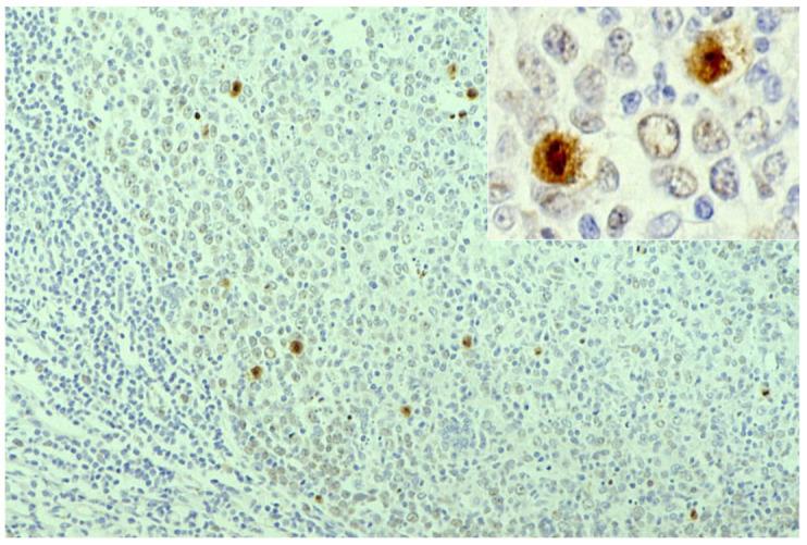 https://cdn.ncbi.nlm.nih.gov/pmc/blobs/3bb4/8232789/e7d1c733075e/cells-10-01501-g042.jpg