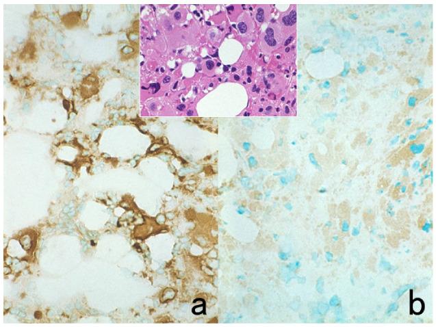 https://cdn.ncbi.nlm.nih.gov/pmc/blobs/3bb4/8232789/e89111c3cdf6/cells-10-01501-g018.jpg