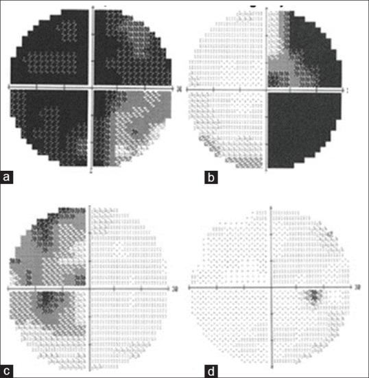 https://cdn.ncbi.nlm.nih.gov/pmc/blobs/3bb6/7057910/124c82e01548/AJNS-15-22-g004.jpg