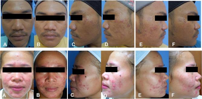 https://cdn.ncbi.nlm.nih.gov/pmc/blobs/3bb8/11453130/4dfdd950dbca/CCID-17-2183-g0006.jpg
