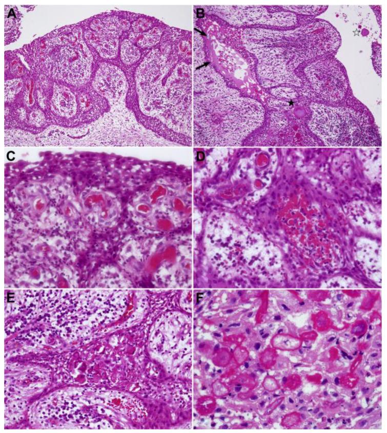 https://cdn.ncbi.nlm.nih.gov/pmc/blobs/3bbd/10742593/7a6e8fe50bc3/dentistry-11-00281-g007.jpg