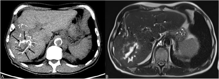 https://cdn.ncbi.nlm.nih.gov/pmc/blobs/3bbf/11265494/c0054ecb735e/gr5.jpg