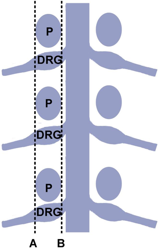 https://cdn.ncbi.nlm.nih.gov/pmc/blobs/3bc3/10324345/ef816c0127a7/CNS-29-1881-g002.jpg