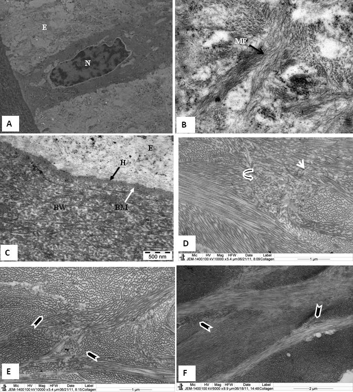 https://cdn.ncbi.nlm.nih.gov/pmc/blobs/3bc5/3171502/6aac0d70f0f3/mv-v17-2283-f2.jpg