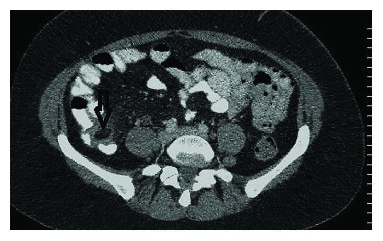 https://cdn.ncbi.nlm.nih.gov/pmc/blobs/3bc8/6350580/429b5d99316c/CRIS2019-6508642.001.jpg