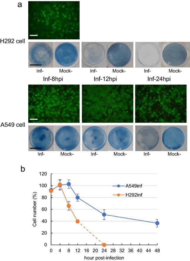https://cdn.ncbi.nlm.nih.gov/pmc/blobs/3bc9/10080527/dee604988500/705_2023_5766_Fig1_HTML.jpg