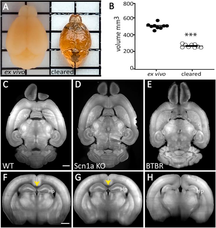 https://cdn.ncbi.nlm.nih.gov/pmc/blobs/3bd8/12172752/1177d064d84a/gr1.jpg