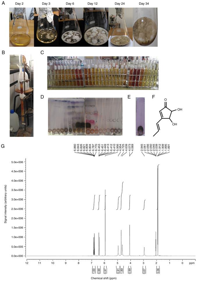 https://cdn.ncbi.nlm.nih.gov/pmc/blobs/3bd9/8047749/5e8bd90ef5eb/or-45-06-8045-g00.jpg