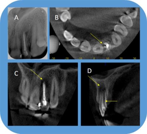 https://cdn.ncbi.nlm.nih.gov/pmc/blobs/3bdb/5750833/1747bb4a70a4/jiufd-051-s102-e023.jpg
